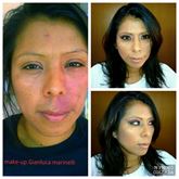 Foto 2 Consulenza trucco post operatorio beauty, camouflage